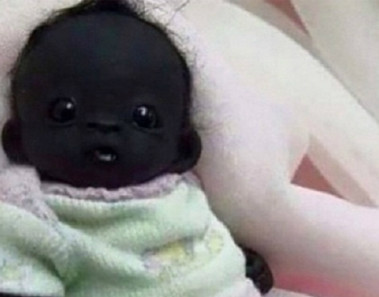 El bebe con la piel mas oscura del mundo