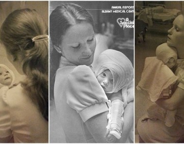 enfermera bebe quemado 1977