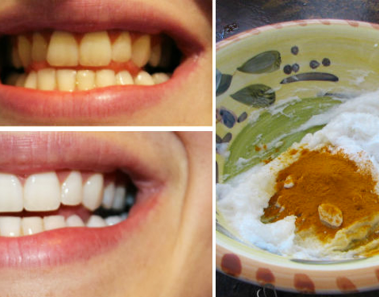 Esta pasta de dientes casera de cúrcuma blanquea tus dientes en 4 minutos