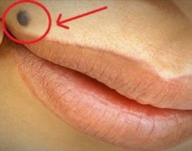 Descubre el increíble significado de tener un lunar encima del labio