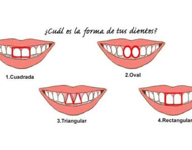 Dime como tienes tus dientes y te diré como eres