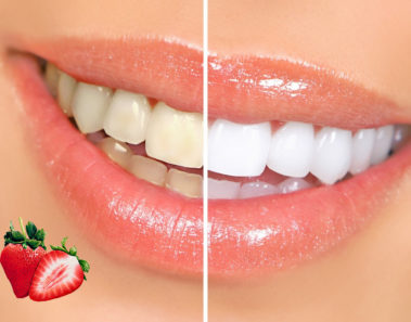 Deliciosa receta con fresas para blanquear los dientes