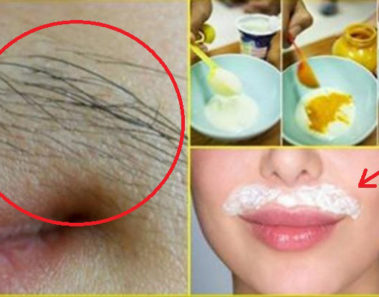 Elimina los vellos de tu cara con esta increíble solución casera
