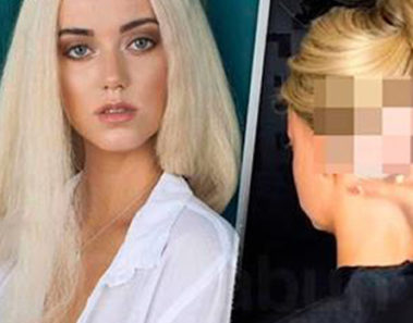 Luego de descubrirse su terrible secreto, esta modelo dejó de ser rica y famosa