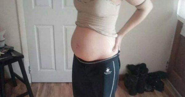 Mujer embarazada publicó una foto de su panza. Cuando la policía vio la foto la arrestó de inmediato