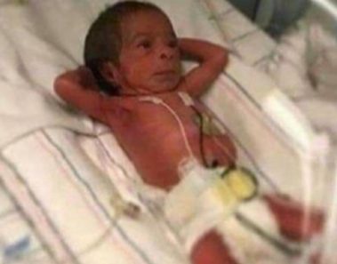 Nació hace algunas horas, pero su foto ya le ha dado la vuelta al mundo. Mira porqué la foto de este bebé se ha vuelto viral…