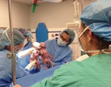 Madre ve llorar a los médicos, mira de cerca a los bebés y entiende lo que está pasando
