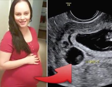 Madre de vientre de alquiler gesta gemelos de otra pareja y descubre que uno de los bebés es suyo