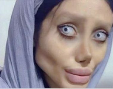 Se hizo 50 cirugías plásticas y perdió 40 kg – todo para verse como su ídolo Angelina Jolie