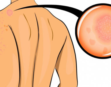 10 alarmas de tu cuerpo que muestran que estás muy estresado