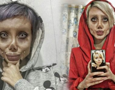 La verdadera historia detrás de la joven que pasó por 50 cirugías…