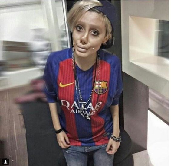 La verdadera historia detrás de la joven que pasó por 50 cirugías…