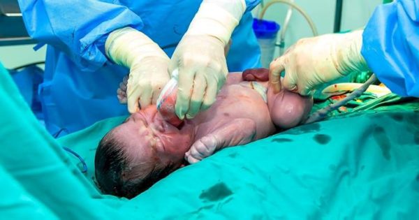 Médicos creen que el bebé nació sano, miran el cordón umbilical otra vez y entienden lo increíble