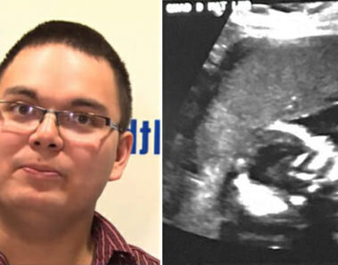 Pareja se queda en shock cuando ve la ecografía – los médicos constatan que es 1 entre 15 millones
