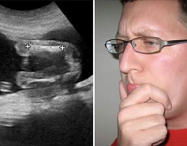 Padre se enfada al ver nacer a su hijo y entonces el doctor revela un vergonzoso detalle sobre su vida sexual