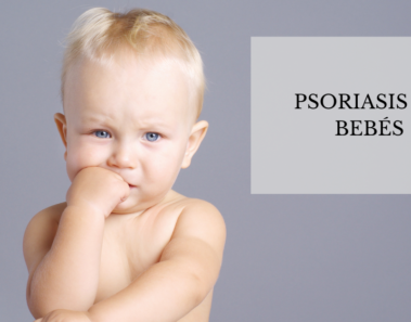 Psoriasis en bebés : Tipos y síntomas