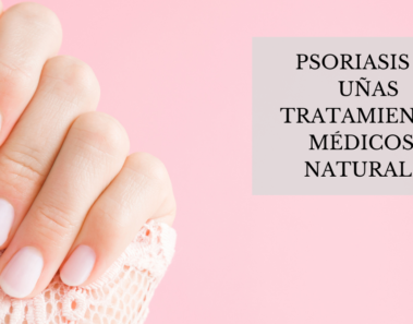 Psoriasis en uñas - Tratamientos médicos y naturales