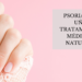Psoriasis en uñas - Tratamientos médicos y naturales